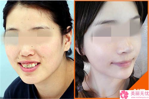 整容要花多少錢就整一張臉？深度解析全臉整形費(fèi)用構(gòu)成與預(yù)算攻略